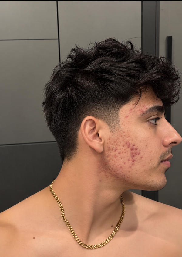 Before photo for Mohit M