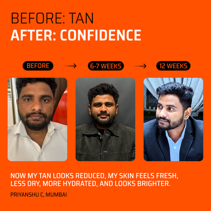 5-IN-1 Detan Brightening Bar for Men (Pack of 3 + 3 Free)